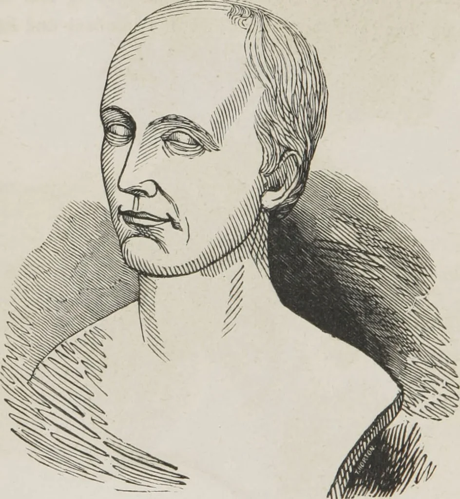 An illustration from Rationale of crime, and its appropriate treatment : being a treatise on criminal jurisprudence considered in relation to cerebral organization / by M.B. Sampson ; with notes and illustrations by E.W. Farnham., 1846, leaf 204