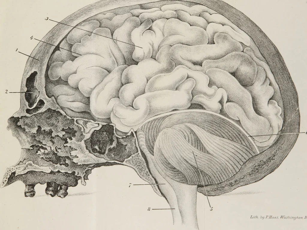 An illustration from An examination of phrenology : in two lectures : delivered to the students of the Columbian College, District of Columbia, February, 1837 / by Thomas Sewall., 1837, leaf 81