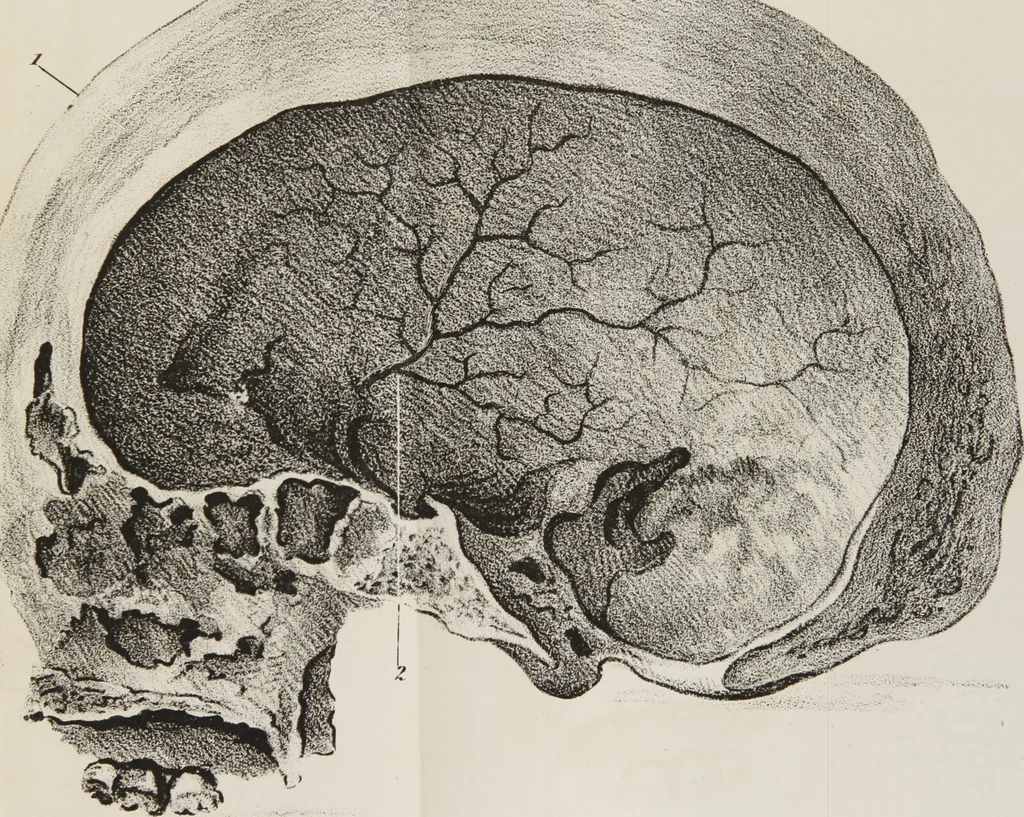 An illustration from An examination of phrenology : in two lectures : delivered to the students of the Columbian College, District of Columbia, February, 1837 / by Thomas Sewall., 1837, leaf 87