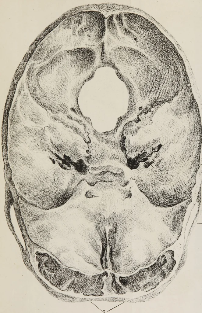 An illustration from An examination of phrenology : in two lectures : delivered to the students of the Columbian College, District of Columbia, February, 1837 / by Thomas Sewall., 1837, leaf 89