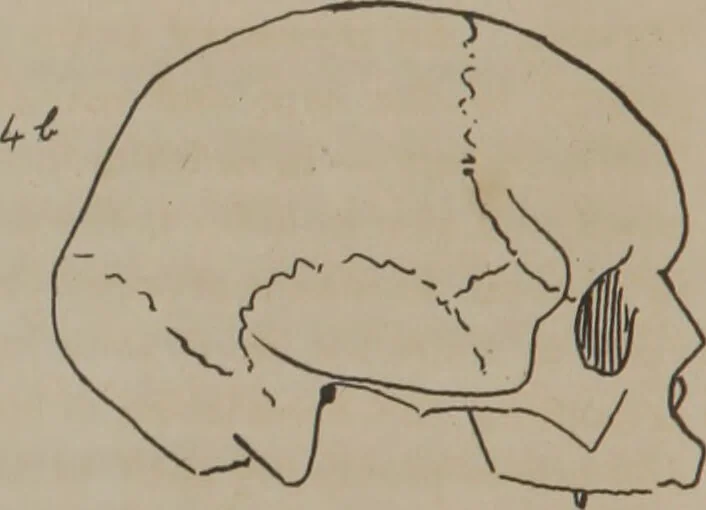 An illustration from Synopsis of phrenology : directed chiefly to the exhibition of the utility and application of the science to the advancement of social happiness / by Joshua Toulmin Smith., 1838, leaf 22