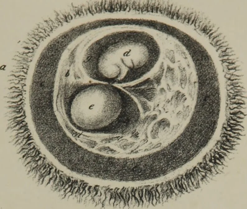 An illustration from Obstetric tables : comprising graphic illustrations, with descriptions and practical remarks : exhibiting on dissected plates many important subjects in midwifery / by G. Spratt., 1848, leaf 41