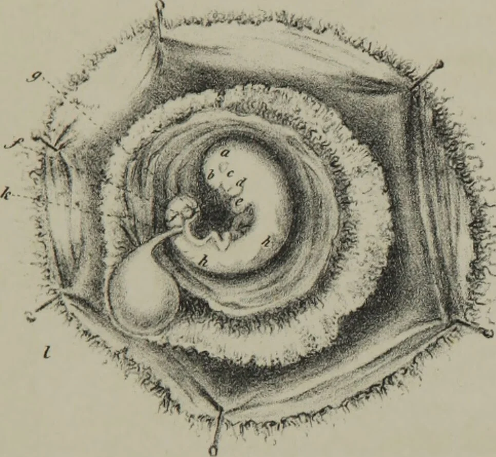 An illustration from Obstetric tables : comprising graphic illustrations, with descriptions and practical remarks : exhibiting on dissected plates many important subjects in midwifery / by G. Spratt., 1848, leaf 41