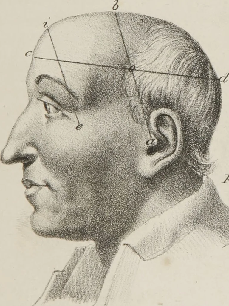 An illustration from Phrenology, in connexion with the study of physiognomy : illustration of characters / by J.G. Spurzheim., 1833, leaf 217
