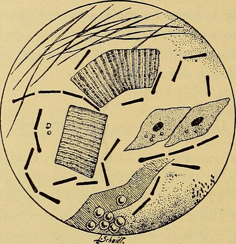 An illustration from Diagnostic methods, chemical, bacteriological and microscopical : a text-book for students and practitioners / by Ralph W. Webster ; with 37 colored plates and 164 other illustrations., 1909, leaf 108