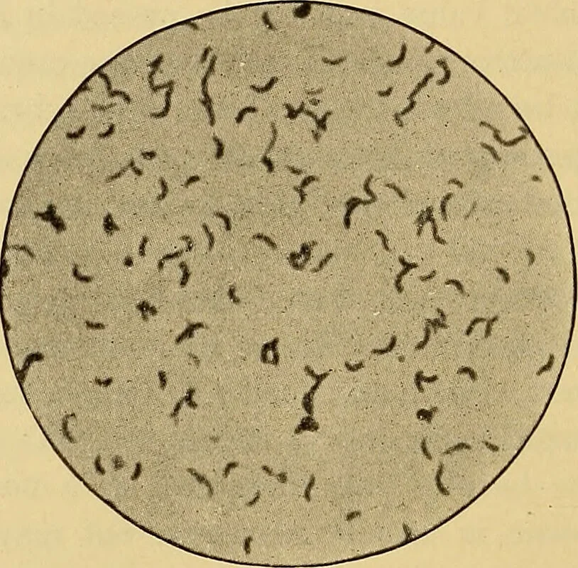 An illustration from Diagnostic methods, chemical, bacteriological and microscopical : a text-book for students and practitioners / by Ralph W. Webster ; with 37 colored plates and 164 other illustrations., 1909, leaf 170