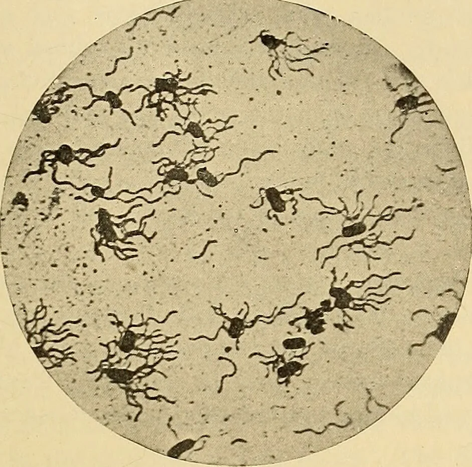 An illustration from Diagnostic methods, chemical, bacteriological and microscopical : a text-book for students and practitioners / by Ralph W. Webster ; with 37 colored plates and 164 other illustrations., 1909, leaf 171