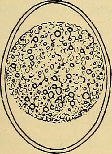 An illustration from Diagnostic methods, chemical, bacteriological and microscopical : a text-book for students and practitioners / by Ralph W. Webster ; with 37 colored plates and 164 other illustrations., 1909, leaf 177