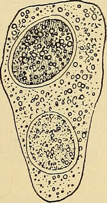 An illustration from Diagnostic methods, chemical, bacteriological and microscopical : a text-book for students and practitioners / by Ralph W. Webster ; with 37 colored plates and 164 other illustrations., 1909, leaf 177