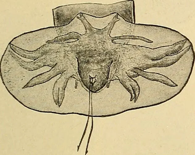 An illustration from Diagnostic methods, chemical, bacteriological and microscopical : a text-book for students and practitioners / by Ralph W. Webster ; with 37 colored plates and 164 other illustrations., 1909, leaf 193