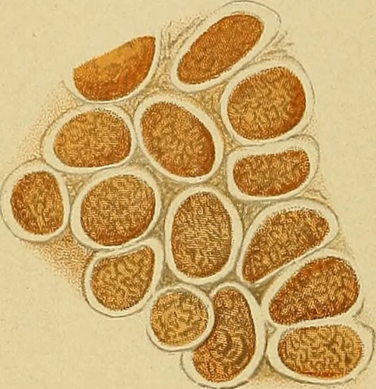 An illustration from Diagnostic methods, chemical, bacteriological and microscopical : a text-book for students and practitioners / by Ralph W. Webster ; with 37 colored plates and 164 other illustrations., 1909, leaf 196