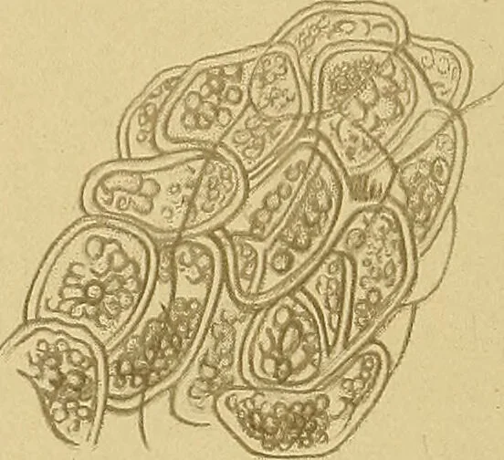 An illustration from Diagnostic methods, chemical, bacteriological and microscopical : a text-book for students and practitioners / by Ralph W. Webster ; with 37 colored plates and 164 other illustrations., 1909, leaf 196