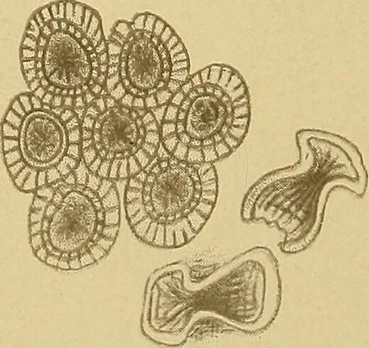 An illustration from Diagnostic methods, chemical, bacteriological and microscopical : a text-book for students and practitioners / by Ralph W. Webster ; with 37 colored plates and 164 other illustrations., 1909, leaf 196