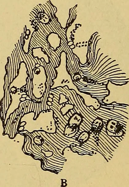 An illustration from Diagnostic methods, chemical, bacteriological and microscopical : a text-book for students and practitioners / by Ralph W. Webster ; with 37 colored plates and 164 other illustrations., 1909, leaf 204