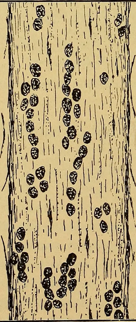 An illustration from Diagnostic methods, chemical, bacteriological and microscopical : a text-book for students and practitioners / by Ralph W. Webster ; with 37 colored plates and 164 other illustrations., 1909, leaf 210