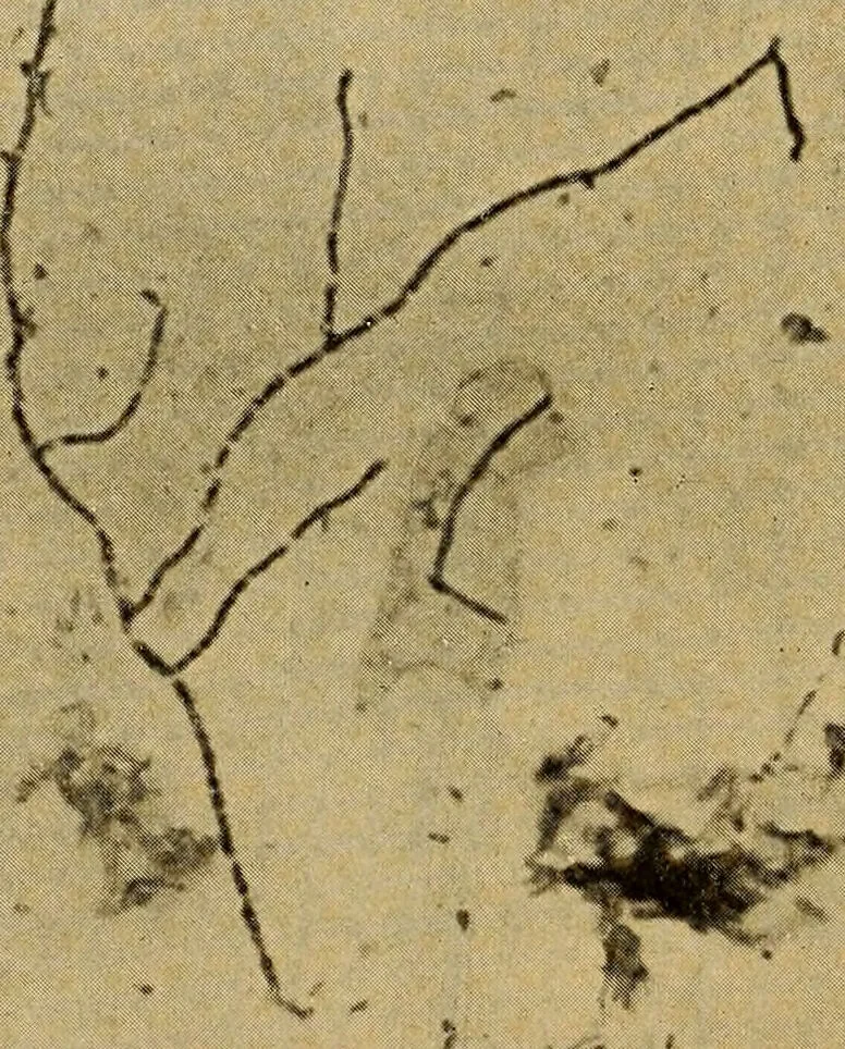 An illustration from Diagnostic methods, chemical, bacteriological and microscopical : a text-book for students and practitioners / by Ralph W. Webster ; with 37 colored plates and 164 other illustrations., 1909, leaf 212