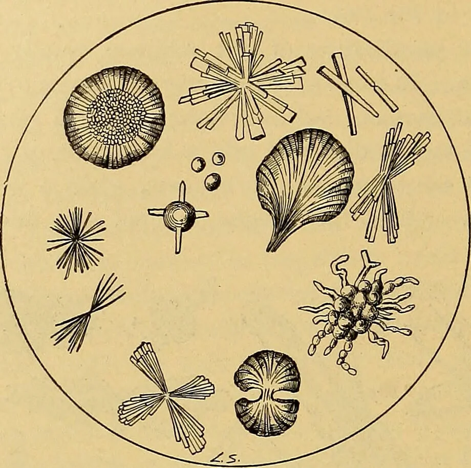 An illustration from Diagnostic methods, chemical, bacteriological and microscopical : a text-book for students and practitioners / by Ralph W. Webster ; with 37 colored plates and 164 other illustrations., 1909, leaf 380
