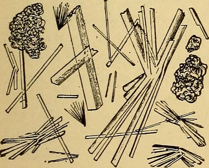 An illustration from Diagnostic methods, chemical, bacteriological and microscopical : a text-book for students and practitioners / by Ralph W. Webster ; with 37 colored plates and 164 other illustrations., 1909, leaf 385
