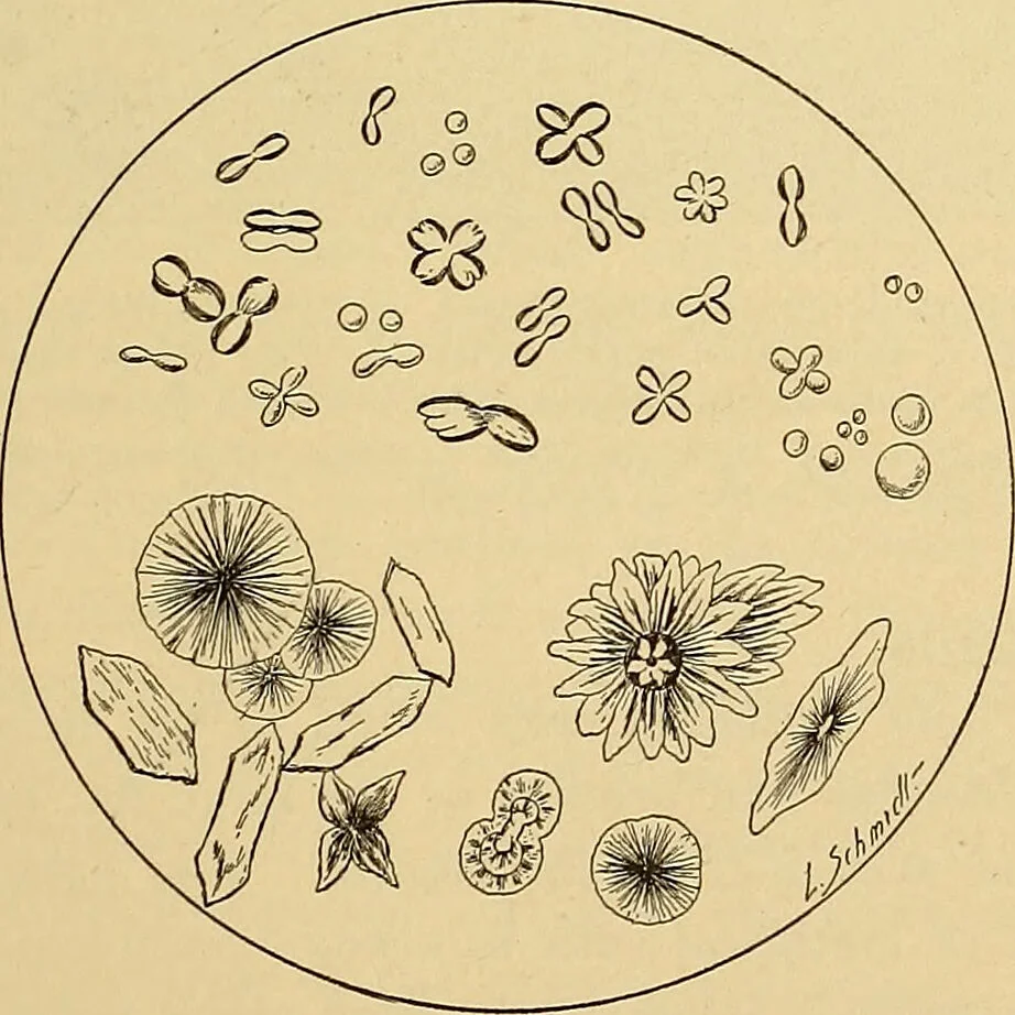 An illustration from Diagnostic methods, chemical, bacteriological and microscopical : a text-book for students and practitioners / by Ralph W. Webster ; with 37 colored plates and 164 other illustrations., 1909, leaf 391