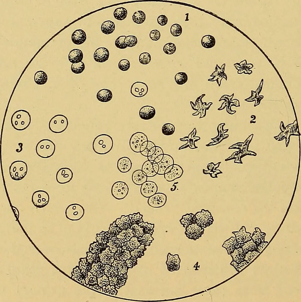 An illustration from Diagnostic methods, chemical, bacteriological and microscopical : a text-book for students and practitioners / by Ralph W. Webster ; with 37 colored plates and 164 other illustrations., 1909, leaf 394