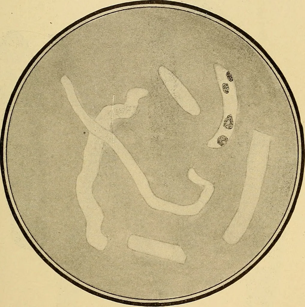 An illustration from Diagnostic methods, chemical, bacteriological and microscopical : a text-book for students and practitioners / by Ralph W. Webster ; with 37 colored plates and 164 other illustrations., 1909, leaf 399