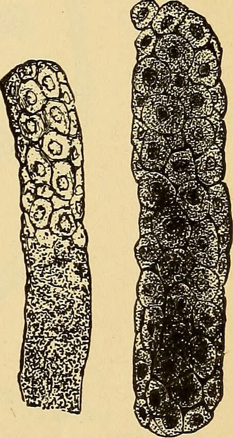 An illustration from Diagnostic methods, chemical, bacteriological and microscopical : a text-book for students and practitioners / by Ralph W. Webster ; with 37 colored plates and 164 other illustrations., 1909, leaf 403