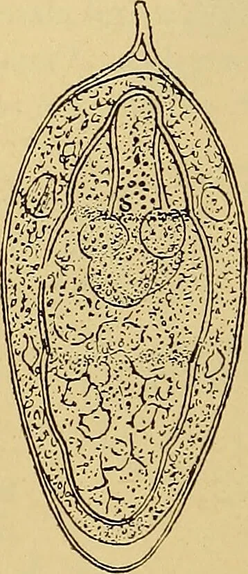 An illustration from Diagnostic methods, chemical, bacteriological and microscopical : a text-book for students and practitioners / by Ralph W. Webster ; with 37 colored plates and 164 other illustrations., 1909, leaf 418