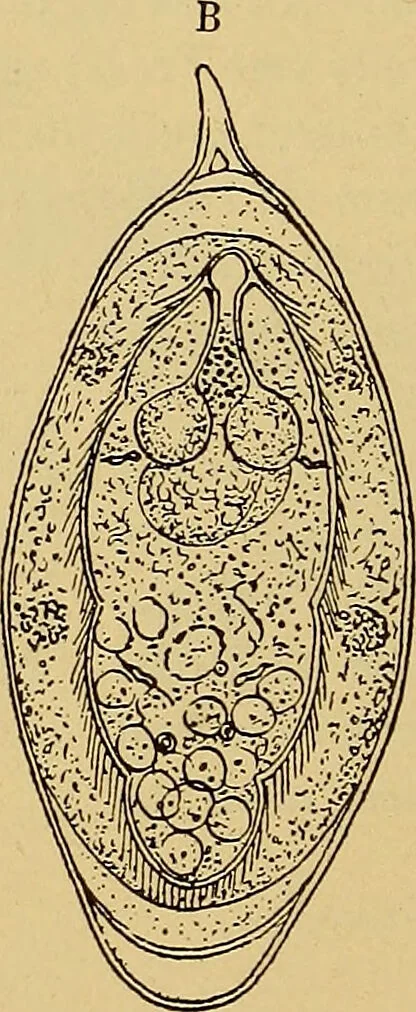 An illustration from Diagnostic methods, chemical, bacteriological and microscopical : a text-book for students and practitioners / by Ralph W. Webster ; with 37 colored plates and 164 other illustrations., 1909, leaf 418