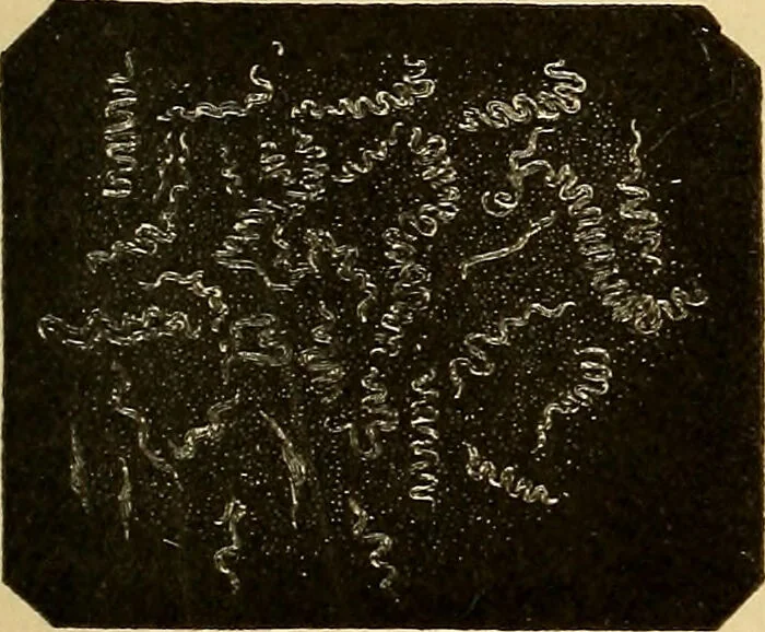 An illustration from Diagnostic methods, chemical, bacteriological and microscopical : a text-book for students and practitioners / by Ralph W. Webster ; with 37 colored plates and 164 other illustrations., 1909, leaf 45