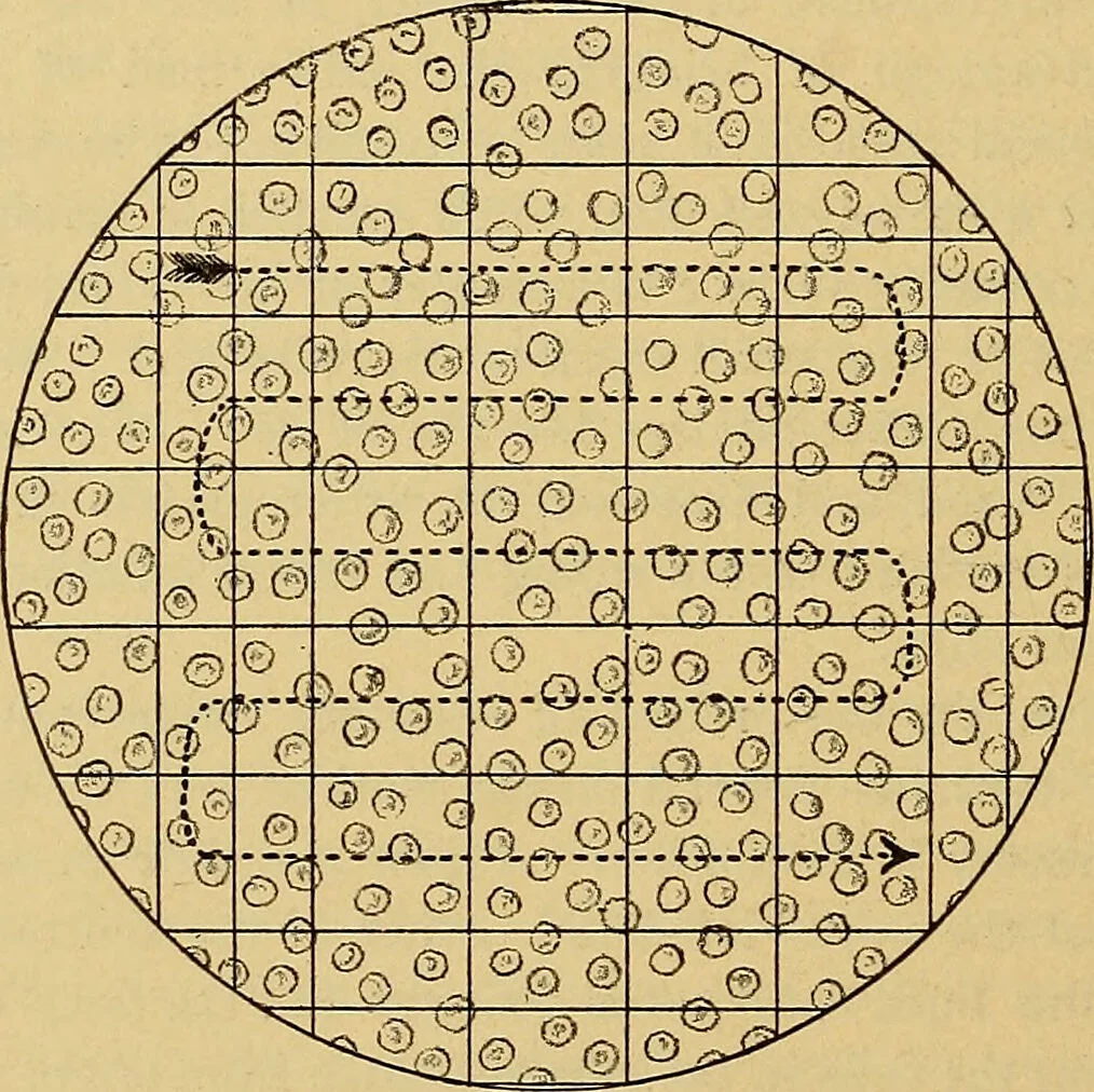 An illustration from Diagnostic methods, chemical, bacteriological and microscopical : a text-book for students and practitioners / by Ralph W. Webster ; with 37 colored plates and 164 other illustrations., 1909, leaf 504