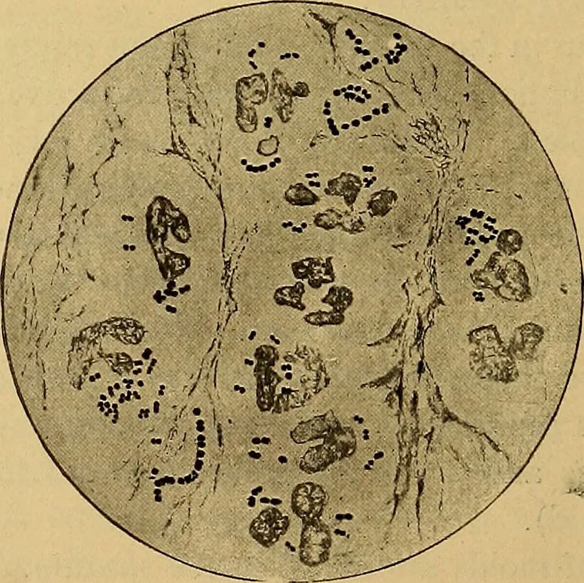 An illustration from Diagnostic methods, chemical, bacteriological and microscopical : a text-book for students and practitioners / by Ralph W. Webster ; with 37 colored plates and 164 other illustrations., 1909, leaf 54
