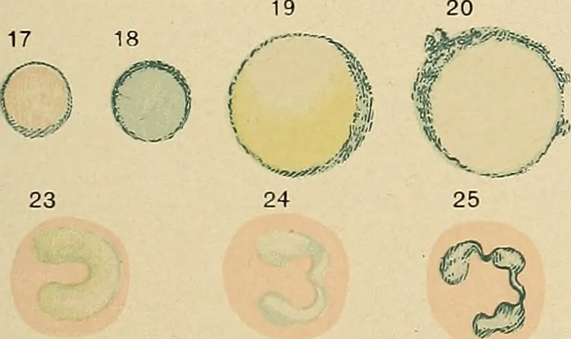 An illustration from Diagnostic methods, chemical, bacteriological and microscopical : a text-book for students and practitioners / by Ralph W. Webster ; with 37 colored plates and 164 other illustrations., 1909, leaf 551