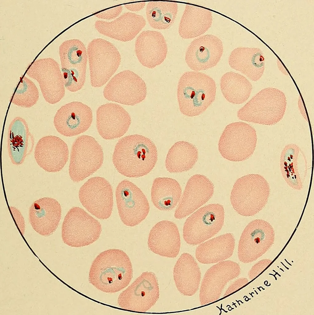 An illustration from Diagnostic methods, chemical, bacteriological and microscopical : a text-book for students and practitioners / by Ralph W. Webster ; with 37 colored plates and 164 other illustrations., 1909, leaf 647