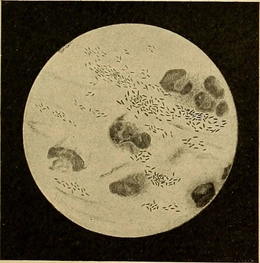 An illustration from Diagnostic methods, chemical, bacteriological and microscopical : a text-book for students and practitioners / by Ralph W. Webster ; with 37 colored plates and 164 other illustrations., 1909, leaf 65