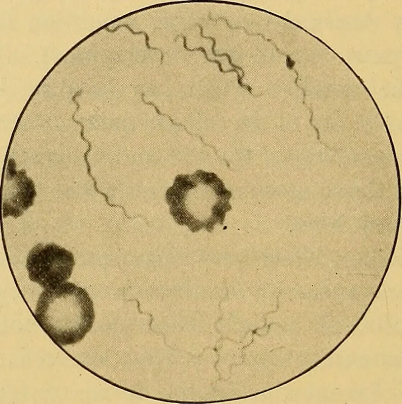An illustration from Diagnostic methods, chemical, bacteriological and microscopical : a text-book for students and practitioners / by Ralph W. Webster ; with 37 colored plates and 164 other illustrations., 1909, leaf 652