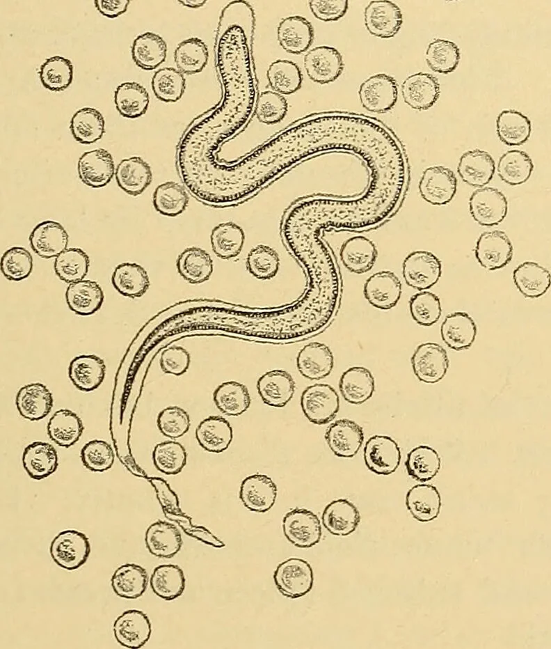 An illustration from Diagnostic methods, chemical, bacteriological and microscopical : a text-book for students and practitioners / by Ralph W. Webster ; with 37 colored plates and 164 other illustrations., 1909, leaf 655