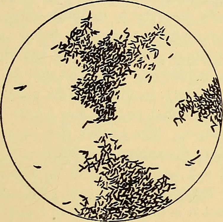An illustration from Diagnostic methods, chemical, bacteriological and microscopical : a text-book for students and practitioners / by Ralph W. Webster ; with 37 colored plates and 164 other illustrations., 1909, leaf 667