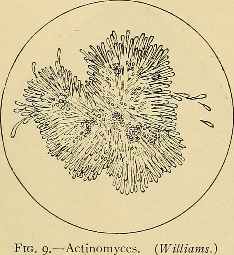 An illustration from Diagnostic methods, chemical, bacteriological and microscopical : a text-book for students and practitioners / by Ralph W. Webster ; with 37 colored plates and 164 other illustrations., 1909, leaf 69