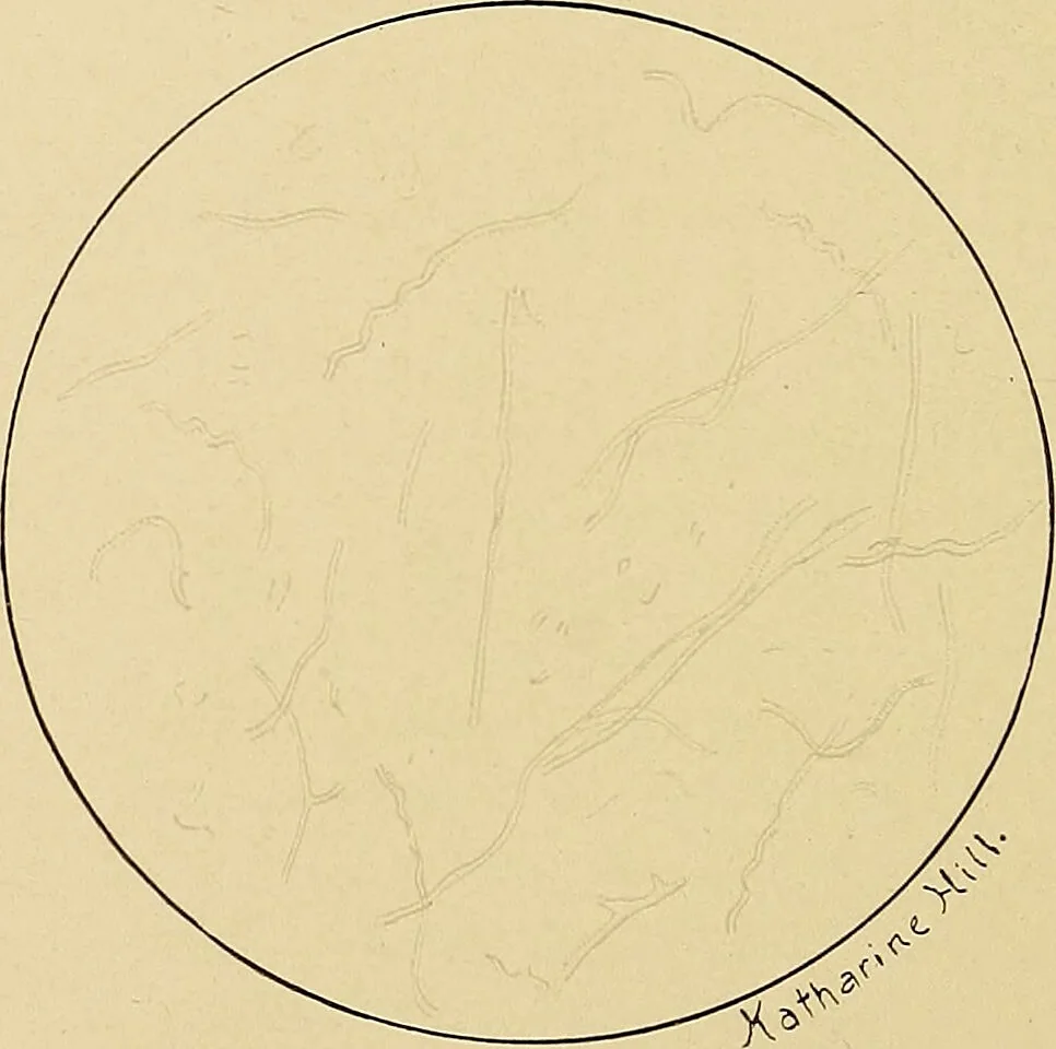 An illustration from Diagnostic methods, chemical, bacteriological and microscopical : a text-book for students and practitioners / by Ralph W. Webster ; with 37 colored plates and 164 other illustrations., 1909, leaf 78