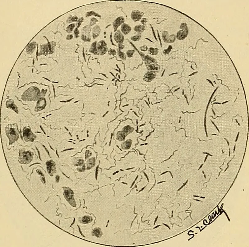 An illustration from Diagnostic methods, chemical, bacteriological and microscopical : a text-book for students and practitioners / by Ralph W. Webster ; with 37 colored plates and 164 other illustrations., 1909, leaf 85