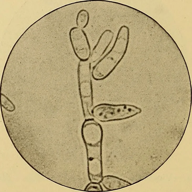 An illustration from Diagnostic methods, chemical, bacteriological and microscopical : a text-book for students and practitioners / by Ralph W. Webster ; with 37 colored plates and 164 other illustrations., 1909, leaf 86