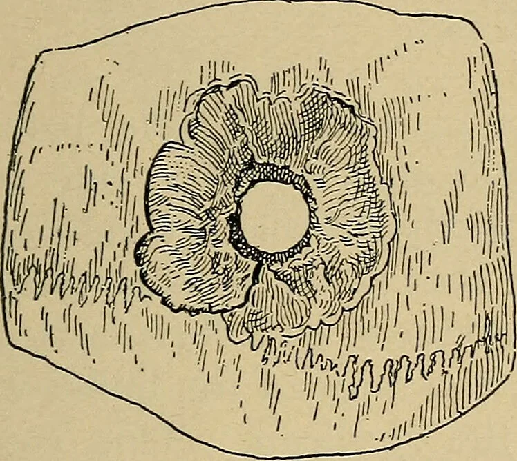 An illustration from Atlas and epitome of traumatic fractures and dislocations / by H. Helferich ; auth. tr. from the German, ed. by Joseph C. Bloodgood., 1902, leaf 111