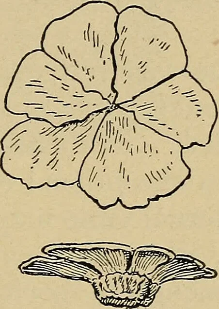 An illustration from Atlas and epitome of traumatic fractures and dislocations / by H. Helferich ; auth. tr. from the German, ed. by Joseph C. Bloodgood., 1902, leaf 111