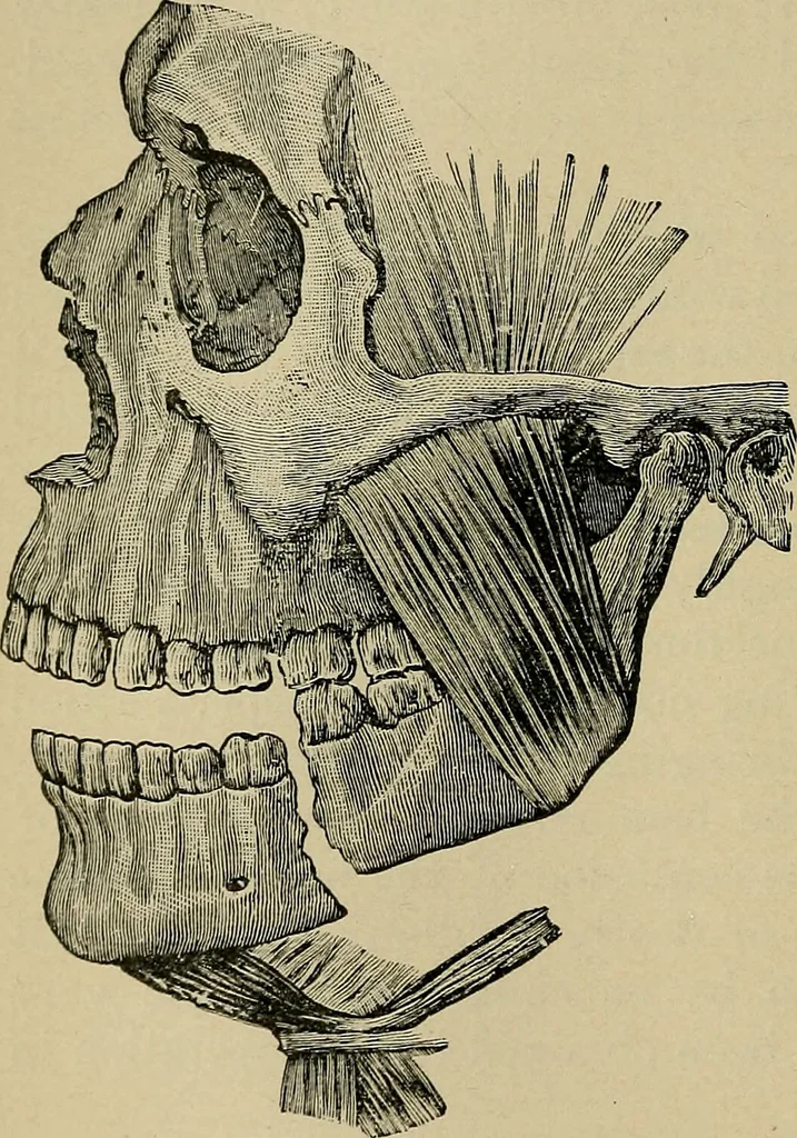 An illustration from Atlas and epitome of traumatic fractures and dislocations / by H. Helferich ; auth. tr. from the German, ed. by Joseph C. Bloodgood., 1902, leaf 138