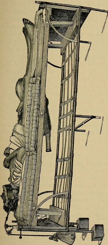 An illustration from Atlas and epitome of traumatic fractures and dislocations / by H. Helferich ; auth. tr. from the German, ed. by Joseph C. Bloodgood., 1902, leaf 159