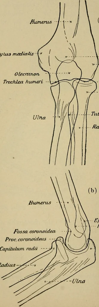 An illustration from Atlas and epitome of traumatic fractures and dislocations / by H. Helferich ; auth. tr. from the German, ed. by Joseph C. Bloodgood., 1902, leaf 248