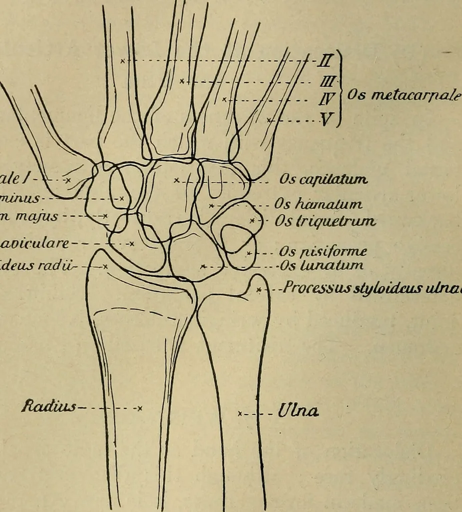 An illustration from Atlas and epitome of traumatic fractures and dislocations / by H. Helferich ; auth. tr. from the German, ed. by Joseph C. Bloodgood., 1902, leaf 330