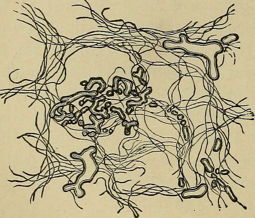 An illustration from Atlas and epitome of traumatic fractures and dislocations / by H. Helferich ; auth. tr. from the German, ed. by Joseph C. Bloodgood., 1902, leaf 72