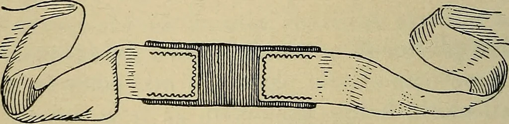 An illustration from Atlas and epitome of traumatic fractures and dislocations / by H. Helferich ; auth. tr. from the German, ed. by Joseph C. Bloodgood., 1902, leaf 94