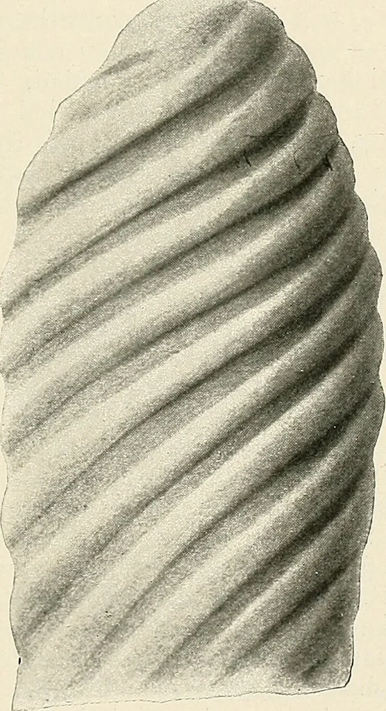 An illustration from Surgery of the lung / by C. Garrè and H. Quincke., 1913, leaf 175